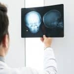 Kanker Kepala dan Leher - Gejala, Penyebab, Biaya Pengobatan